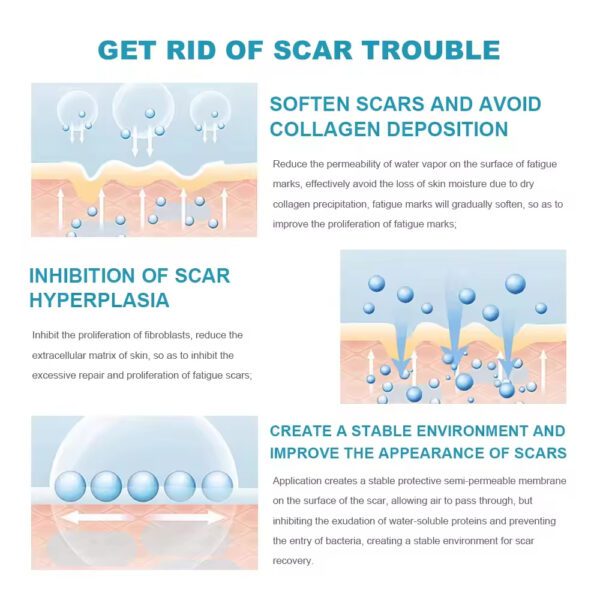 Repair Cream Lightening Ointment Cold Compress Gel Smooth Repair Scar Cream Scar Disapear Remove Gel - Image 5
